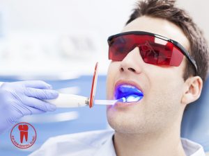 Teeth whitening methods in the dental office has grown in popularity